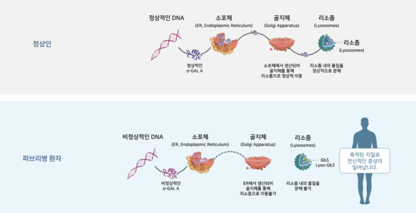 대표적인 리소좀 축적질환 중 하나인 파브리병의 발병 기전. 사진/파브리코리아 홈페이지 캡처