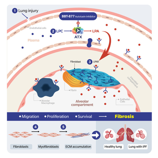 브릿지바이오테라퓨틱스 BBT-877 기전. 사진/브릿지바이오테라퓨틱스