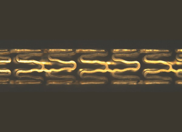 시지메드텍이 개발 중인 '생체분해성 혈관스텐트' 구현 이미지. 사진/시지메드텍